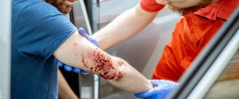 Criminal Negligence Causing Bodily Harm Criminal Negligence Causing Bodily Harm